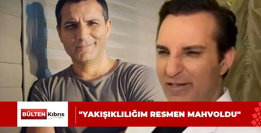 Rafet El Roman’ın estetik pişmanlığı: Yakışıklılığım resmen mahvoldu