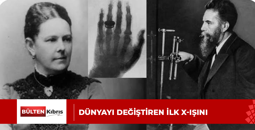 Dünyayı Değiştiren İlk X-Işını